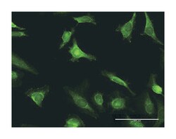 exostoses (multiple) 1, Rabbit, Purified MaxPab Polyclonal Antibody, Abnova 100 &mu;g | Buy Online | Abnova | Fisher Scientific