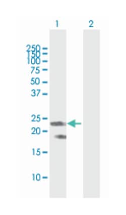 F8, Rabbit, MaxPab Polyclonal Antibody, Abnova 100&mu;L; Unlabeled:Antibodies,
