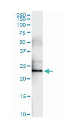 F8, Rabbit, MaxPab Polyclonal Antibody, Abnova 100&mu;L; Unlabeled:Antibodies,