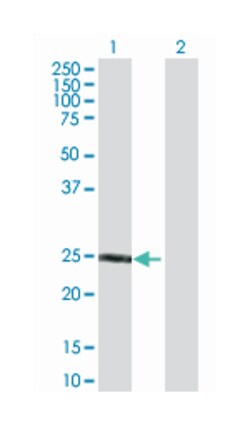 coagulation factor VIII, procoagulant component, Rabbit, Purified MaxPab Polyclonal Antibody, Abnova 100 &mu;g | Buy Online | Abnova | Fisher Scientific