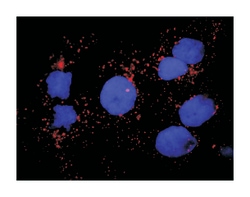 coagulation factor XIII, A1 polypeptide, Mouse, Clone: M1, Abnova 100&mu;g;
