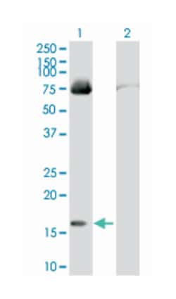 fatty acid binding protein 4, adipocyte, Mouse, Polyclonal Antibody, Abnova 50 &mu;L | Buy Online | Abnova | Fisher Scientific