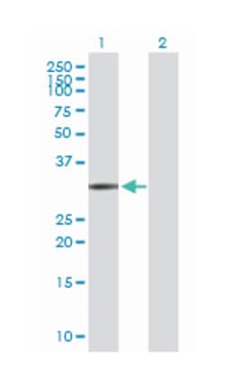 ficolin (collagen/fibrinogen domain containing) 1, Rabbit, Purified MaxPab