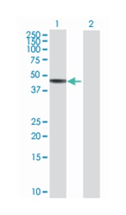 FDFT1, Mouse, Polyclonal Antibody, Abnova 50 &mu;L | Buy Online | Abnova | Fisher Scientific