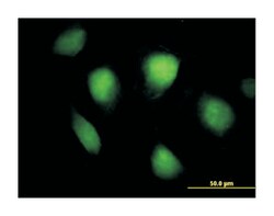 FHL1 (B01), Mouse anti-Human, Polyclonal Antibody, Abnova 50&mu;g; Unlabeled:Antibodies,