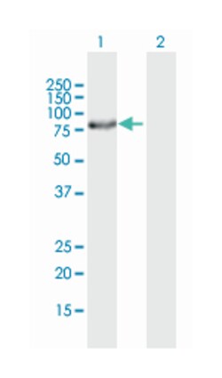 excision repair cross-complementing rodent repair deficiency, complementation