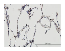 enhancer of rudimentary homolog (Drosophila), Mouse, Clone: 4A10, Abnova 100 &mu;g | Buy Online | Abnova Corporation | Fisher Scientific