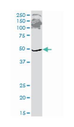 ETF1, Mouse, Clone: 2H4, Abnova 100&mu;g; Unlabeled:Antikörper