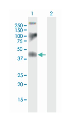 F2R, Mouse, Polyclonal Antibody, Abnova 50&mu;L; Unlabeled:Antibodies,