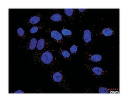 coagulation factor XIII, A1 polypeptide, Mouse, Clone: M1, Abnova 100&mu;g;