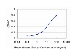 coagulation factor XIII, A1 polypeptide, Mouse, Clone: M1, Abnova 100&mu;g;