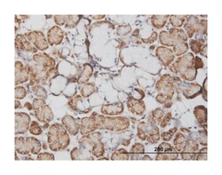 FABP4, Mouse, Clone: 3G1, Abnova 100&mu;g; Unlabeled:Antibodies, Monoclonal