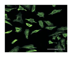 FABP4, Mouse, Clone: 3G1, Abnova 100&mu;g; Unlabeled:Antibodies, Monoclonal