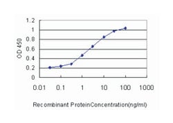 fatty acid binding protein 3, muscle and heart (mammary-derived growth
