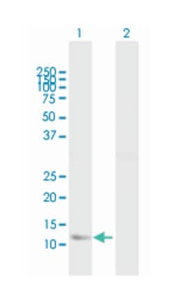 fatty acid binding protein 5 (psoriasis-associated), Mouse, Polyclonal