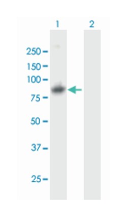 fibulin 1, Mouse, Polyclonal Antibody, Abnova 50&mu;L; Unlabeled:Antibodies,