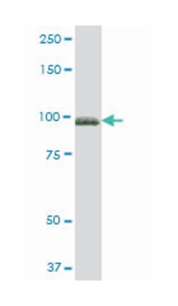 fibulin 1, Mouse, Polyclonal Antibody, Abnova 50&mu;L; Unlabeled:Antibodies,
