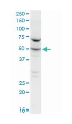 phenylalanyl-tRNA synthetase, alpha subunit (A01), Mouse anti-Human, Mouse,