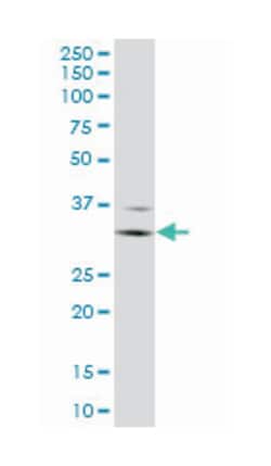FCGR3A (M03), Mouse anti-Human, Clone: 2B11, Abnova 50&mu;g; Unlabeled:Antibodies,
