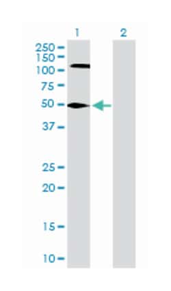 flap structure-specific endonuclease 1, Rabbit, Purified MaxPab™ Polyclonal Antibody, Abnova™