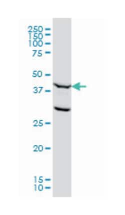 flap structure-specific endonuclease 1, Mouse, Clone: 1E2, Abnova 200&mu;L;