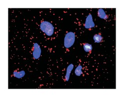 FGF1, Mouse, Clone: 3F5, Abnova 100 &mu;g | Buy Online | Abnova | Fisher Scientific