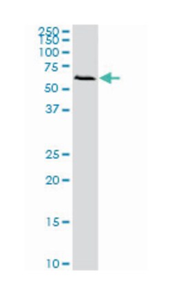 FGR, Mouse, Clone: 1B12, Abnova 100&mu;g; Unlabeled:Antibodies, Monoclonal