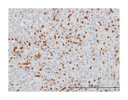 FGR, Mouse, Clone: 1B12, Abnova 100&mu;g; Unlabeled:Antibodies, Monoclonal