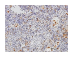 FGR, Mouse, Clone: 3F2, Abnova 100&mu;g; Unlabeled:Antibodies, Monoclonal