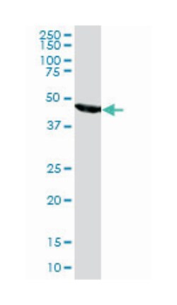 FH, Mouse, Clone: 5D8, Abnova&trade;