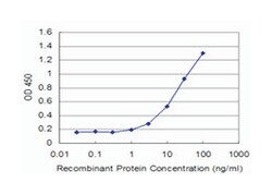 FOXO1A, Mouse, Clone: 1F11, Abnova 100&mu;g; Unlabeled:Anticuerpos