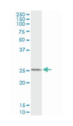 FXN, Mouse, Clone: 1D9, Abnova 100&mu;g; Unlabeled:Antibodies, Monoclonal