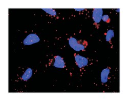 glycoprotein Ib (platelet), alpha polypeptide, Rabbit, Purified MaxPab