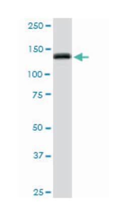 GTF2I, Mouse, Polyclonal Antibody, Abnova 50 &mu;L | Buy Online | Abnova | Fisher Scientific