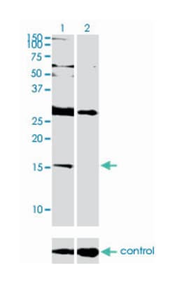 inhibitor of DNA binding 2, dominant negative helix-loop-helix protein,