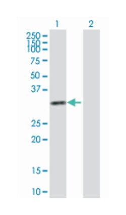 ketohexokinase (fructokinase), Rabbit, Purified MaxPab Polyclonal Antibody,