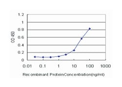 keratin 17, Mouse, Clone: 2D10, Abnova&trade;
