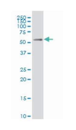 MEIS2, Mouse, Clone: 1B3, Abnova 200&mu;L; Unlabeled:Antibodies, Monoclonal
