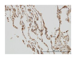 nuclear factor of kappa light polypeptide gene enhancer in B-cells inhibitor,