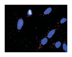 Parkinson disease (autosomal recessive, juvenile) 2, parkin, Rabbit, Purified