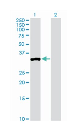 protein phosphatase 1, regulatory (inhibitor) subunit 3C (D01P), Rabbit