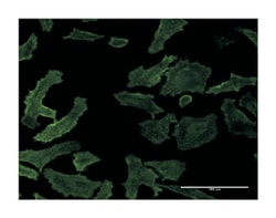 RASA1, Mouse, Clone: 1E6, Abnova 100&mu;g; Unlabeled:Antibodies, Monoclonal