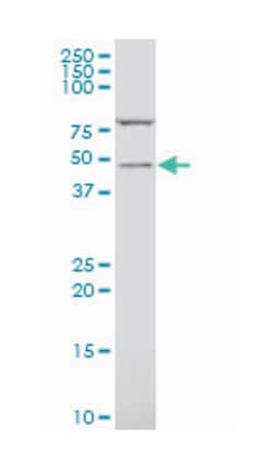 solute carrier family 18 (vesicular monoamine), member 2, Mouse, Polyclonal