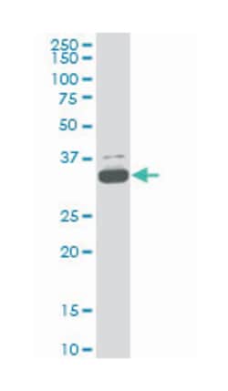 TAF11 RNA polymerase II, TATA box binding protein (TBP)-associated factor,