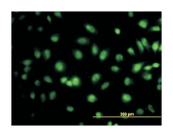 transcription elongation factor B (SIII), polypeptide 3 (110kDa, elongin