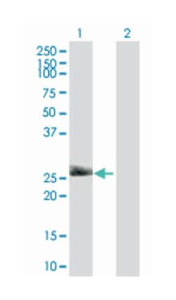 Thy-1 cell surface antigen, Mouse, Polyclonal Antibody, Abnova™