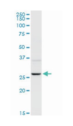 uroporphyrinogen III synthase, Rabbit, Purified MaxPab Polyclonal Antibody,