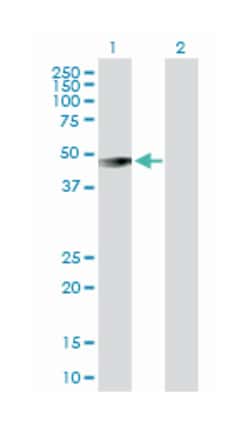 gastric intrinsic factor (vitamin B synthesis), Rabbit, Purified MaxPab