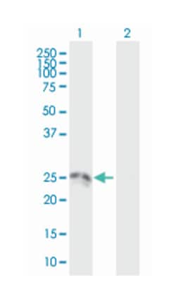 hydroxysteroid (17-beta) dehydrogenase 10, Mouse, Polyclonal Antibody,