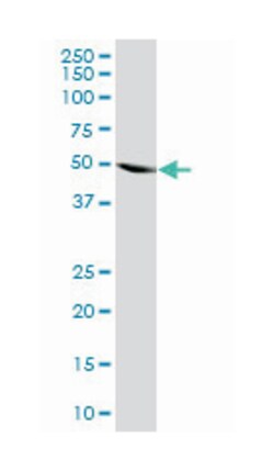 HARS (M03A), Mouse anti-Human, Clone: 4D4, Abnova 200 &mu;L | Buy Online | Abnova | Fisher Scientific